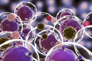 Liquid Biopsies for cancer in pcmc